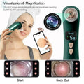 Heating Blackhead Suction - Aevanti